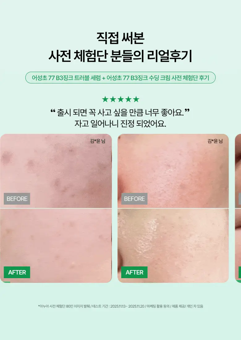 [박희선Pick] 아누아 어성초 77 B3 징크 수딩 크림 80ml 상세페이지 29